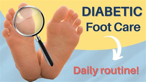 Diabetic Foot Care At Home 🎯 Daily Routine Youtube