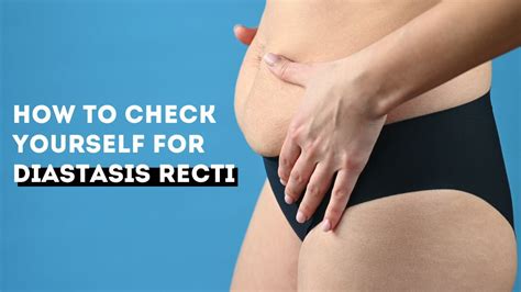 How To Check Yourself For Diastasis Recti