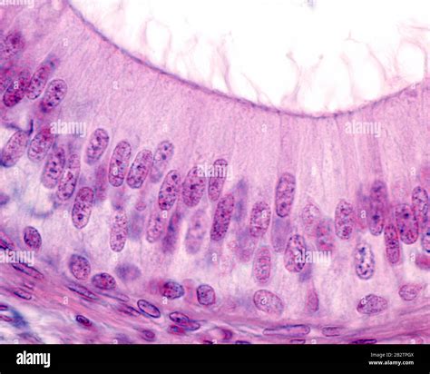 Pseudostratified Columnar Epithelium Of The Epididymis The Epithelial Cells Show Stereocilia In