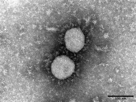 変異株「デルタ株」 なぜ怖いの？ 感染防ぐには？ ワクチンの有効性は＜新型コロナ＞ ：東京新聞デジタル