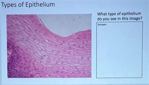 Solved Types of Epithelium What type of epithelium do you | Chegg.com