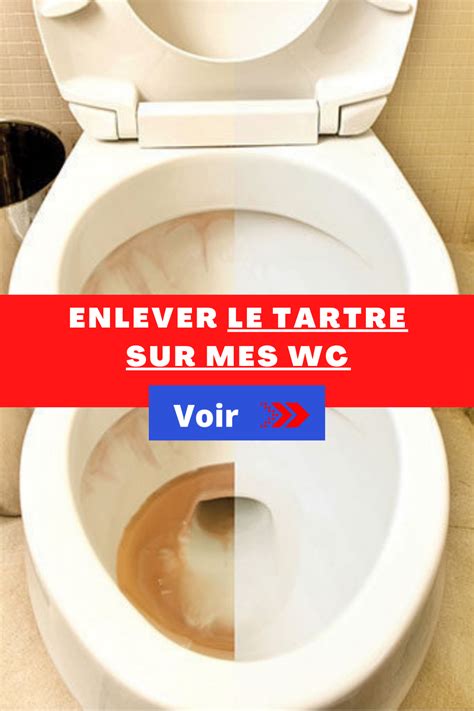 Astuces Simples Et Efficaces Contre Le Tartre Dans Les Wc En