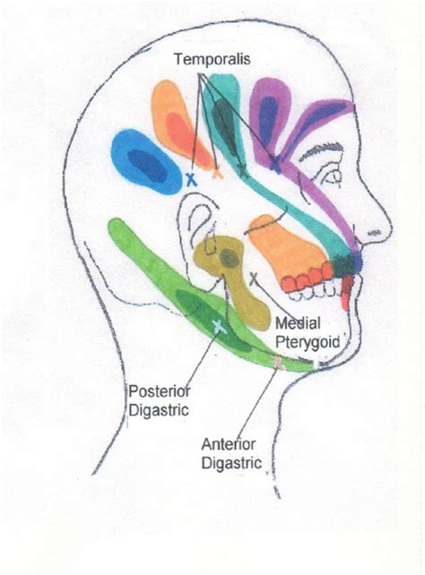 Head Neck And Shoulder Trigger Point Chart 2 Copyright American