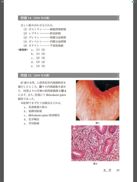 電子書籍版｜日本消化器病学会専門医資格認定試験問題・解答と解説 第5集 M2plus