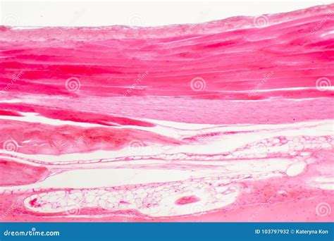 Dense Connective Tissue Stock Photo Image Of Anatomy 103797932