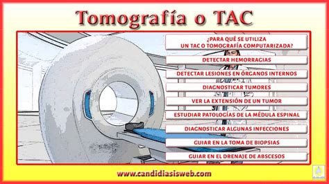 Que Son Las Tac Y Ejemplos Otosection