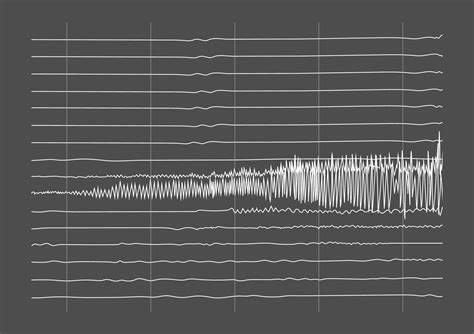 illustration  ictal eeg recording  seizure  vector art