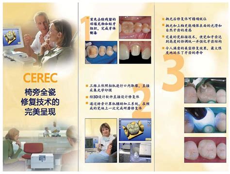 瓷睿刻cerec修复 Hkdental