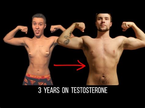 Female To Male Transition Years On Testosterone Youtube