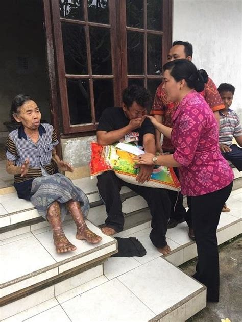 Dikunjungi Ny Giri Prasta Lempung Langsung Dirawat Di Rsud Mangusada