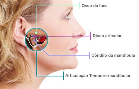 Bruxismo Anatomia Atm Lu S Gustavo Leite Dentista Especialista Em