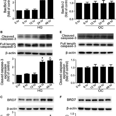 Inhibition Of ERK Pathway Reduced High Glucose Induced Expression Of