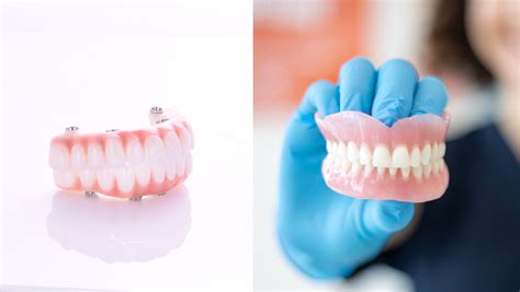 Dentures Vs Dental Implants Which Is Right For You Britely