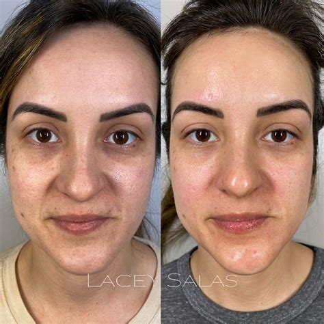 Get Started with BioRepeelCL3