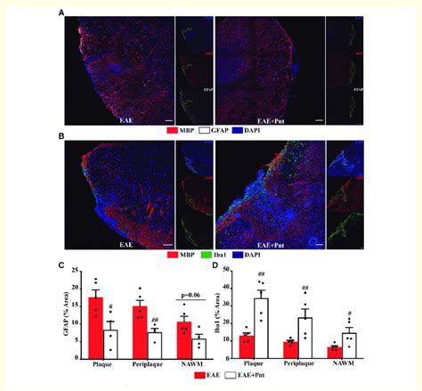 Pentamidine Treatment Partially Reduce Astroglial Reactivity And