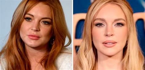 Pai nega que Lindsay Lohan tenha feito plásticas para mudar visual