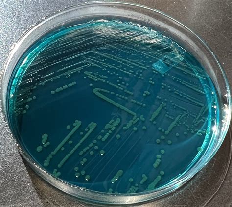 Xld Agar Shigella