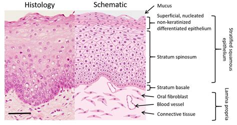 Oral Candidiasis Histology