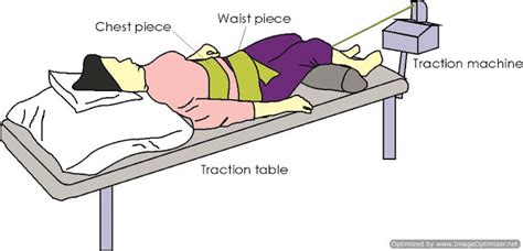 What Is Lumbar Traction In Physiotherapy Physiosunit