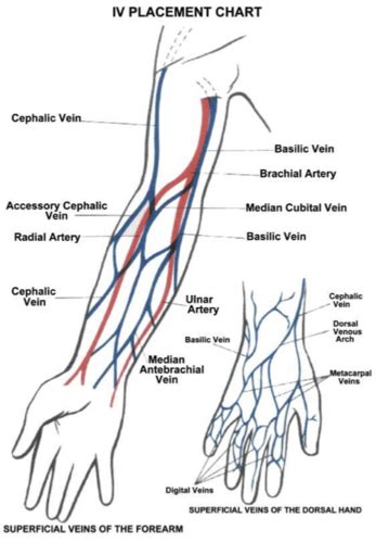 Unit 8-D Peripheral Intravenous Catheter Insertion Flashcards | Quizlet