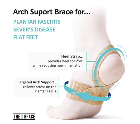 Xbrace Foot And Arch Support Braces By Medi Dyne