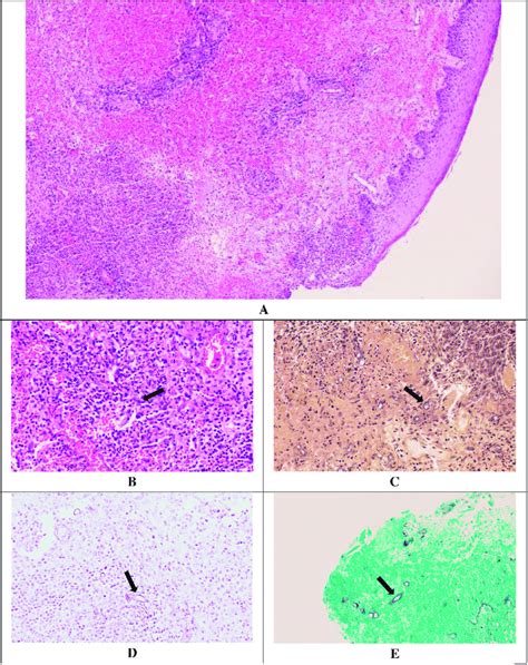 Histopathology Sections Showing A 10x Magnification H And E Epidermal Download Scientific