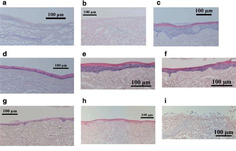 Figure 1 From Tissue Engineered Constructs Of Human Oral Mucosa