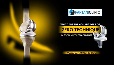 What Are The Advantages Of Zero Error Total Knee Replacement Surgery