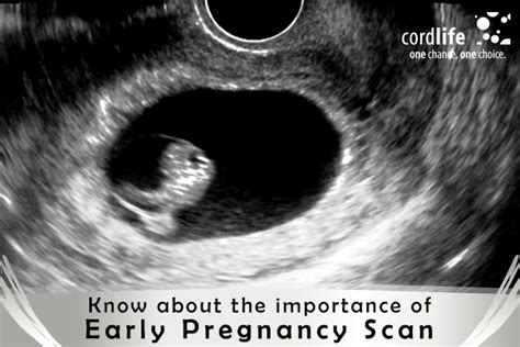 Know About The Importance Of Early Pregnancy Scan