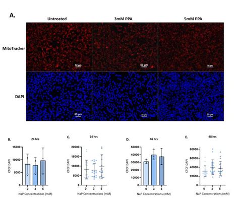 Mitochondrial Membrane Potential Remains Unchanged After Propionic Acid