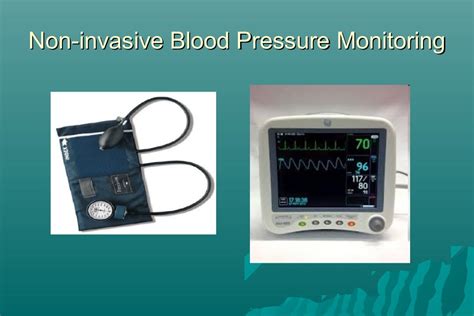 Hemodynamic Monitoring