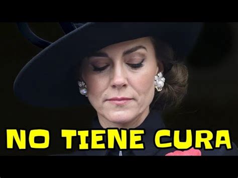 Filtran Por Error Grave Enfermedad De Kate Middleton Y No Tiene Cura