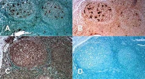 TUNEL Assay Kit - HRP-DAB (ab206386) | Abcam