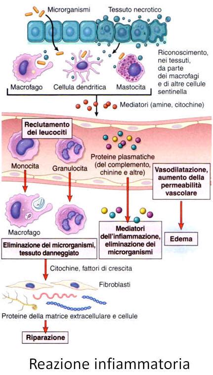 Tipi Di Infiammazione Cronica