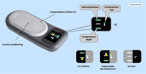 What Does A Chest Compression Feedback Device Monitor Do?