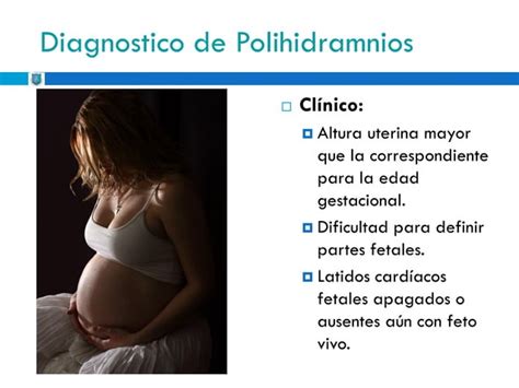 Oligohidramnios Y Polihidramnios Ppt