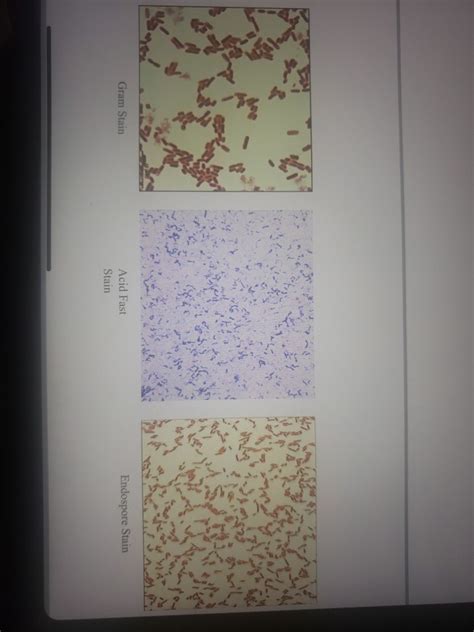 Solved Gram Stain Endospore Stain Acid Fast Stain Chegg