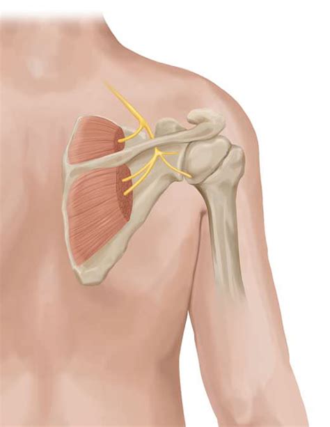 Chronic Shoulder Pain Treatment Severe Shoulder Pain Pain Spa