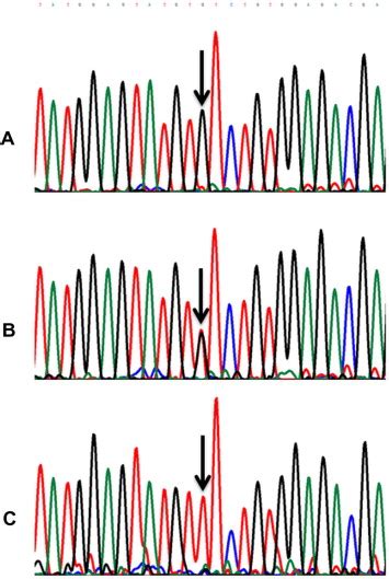 Dna Sequence Chromatograms Of The C1849g→t Jak2v617f Mutation In Download Scientific Diagram