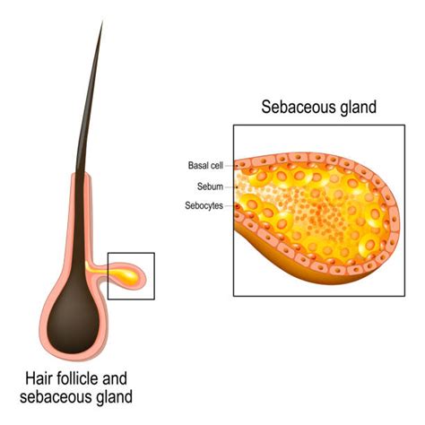 Sebaceous Glands Acne