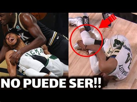 MALAS NOTICIAS LESION DE GIANNIS ANTETOKOUNMPO Qué pasó YouTube