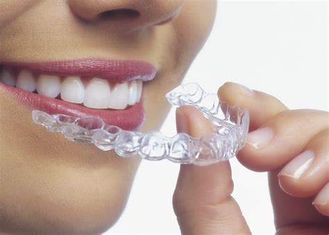 Understanding How Invisalign Aligners Are Made And How To Care For Them