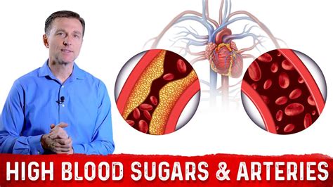 The Effects Of High Blood Sugar On Arteries Dr Berg On