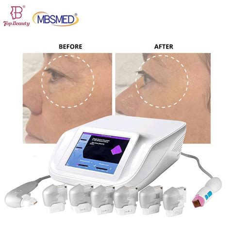 High Intensity Focused Ultrasound Facial Lifting Hifu 7D Hifu Mmfu