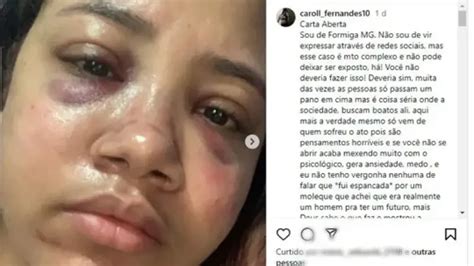 Mulher Exp E Agress O Do Ex Marido Em Rede Social Rep Rter Beto Ribeiro