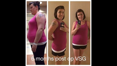 Month Surgiversary Weeks Post Op Vsg Body Shot Youtube