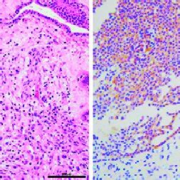 Histopathological Examination Of The Specimen Obtained During Surgery