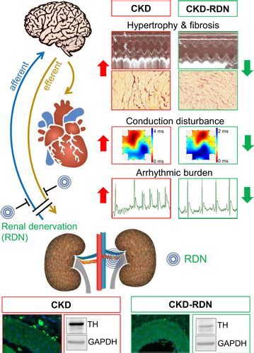 Renal Denervation Prevents Atrial Arrhythmogenic Substrate Development