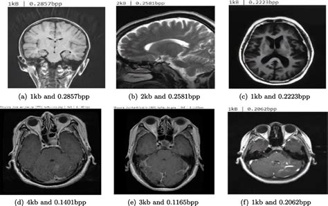 Description of Compressed Medical MRI images with size | Download Scientific Diagram