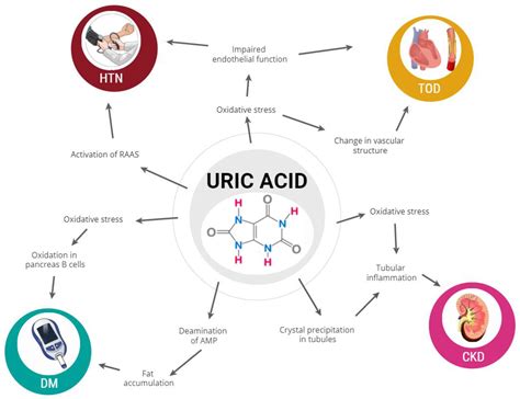 The Role Of Uric Acid In Acute And Chronic Coronary Syndromes